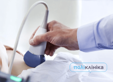 акционное лето