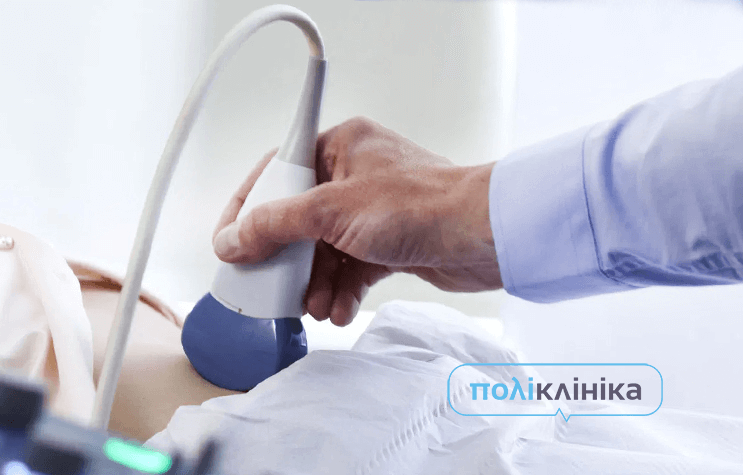 Акційне літо