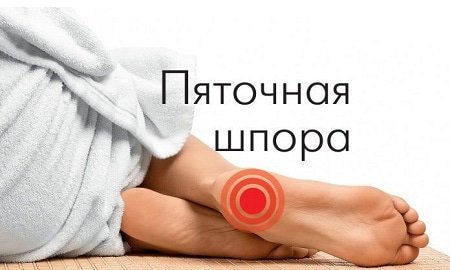 П’яткова шпора – 💯% знижка на першу процедуру!