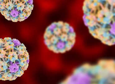 Радиоволновое удаления папиллом это удобно и безболезненно