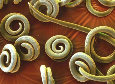 Паразиты в организме