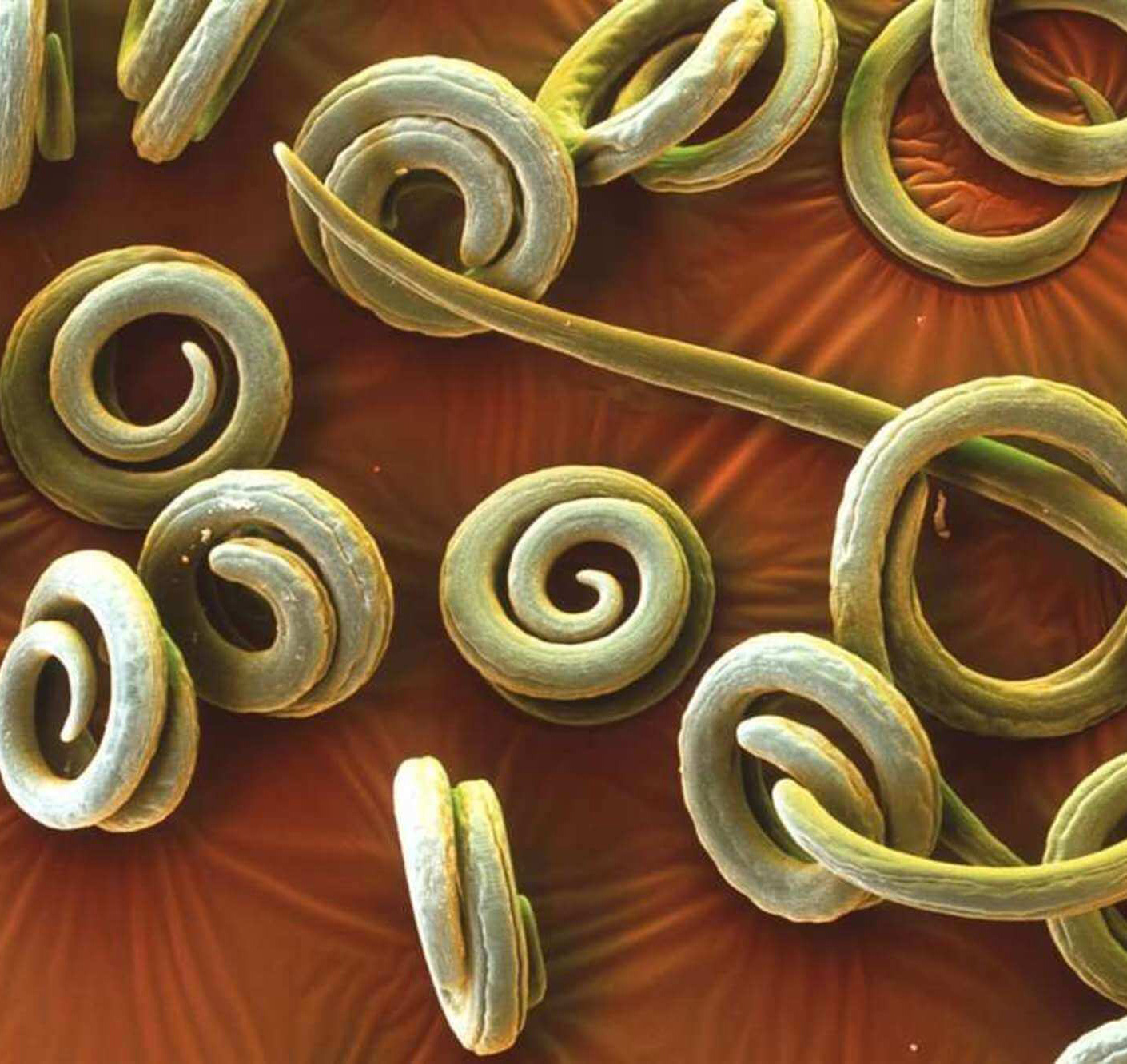 Паразити в організмі