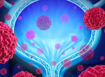 Немного о цистите