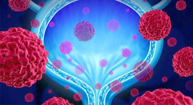 Немного о цистите