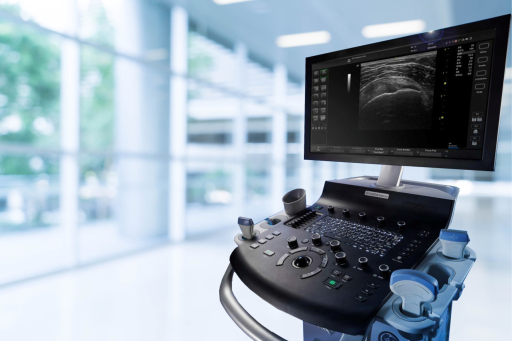 УЗД - ультразвукова діагностика