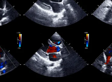 Сердце на экране - Важность и процедура УЗИ диагностики