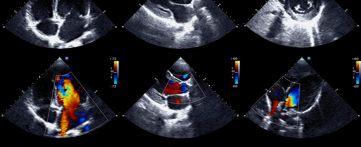 Серце на екрані – Важливість та процедура УЗД діагностики