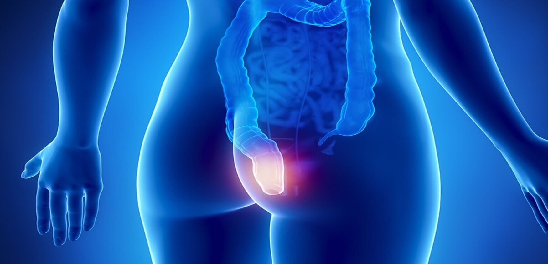 Парапроктит – Як вчасно розпізнати і запобігти ускладненням