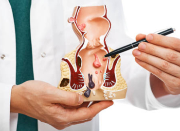 Медикаментозное лечение геморроя-эффективные методы без операции