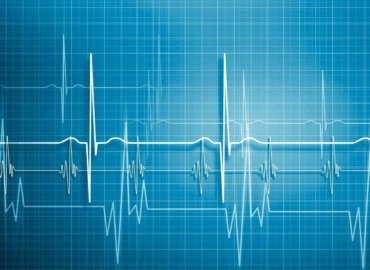 Тахикардия – признаки, причины и лечебные методы