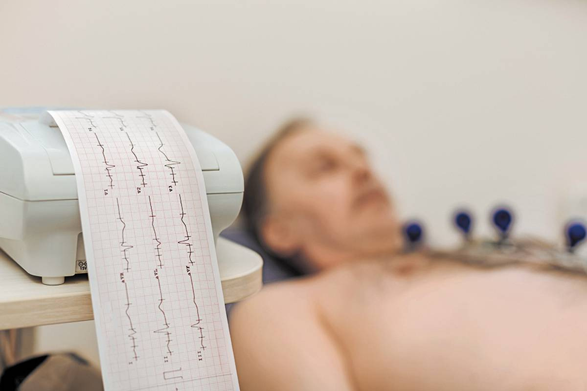 Фібриляція передсердь, або миготлива аритмія. Що це і як з нею жити?