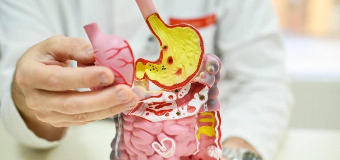 Фото: лечение язвы желудка и двенадцатиперстной кишки