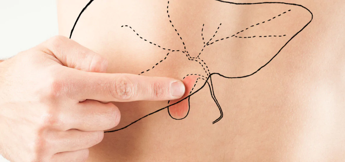 Фото: Лечение холецистита