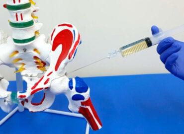 Укол у тазостегновий суглоб - Унікальна пропозиція від нашого медичного центру!