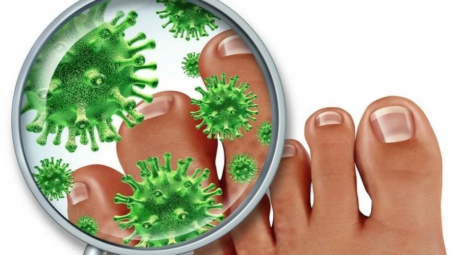 Фото: Лікування мікозу (грибка) гладкої шкіри