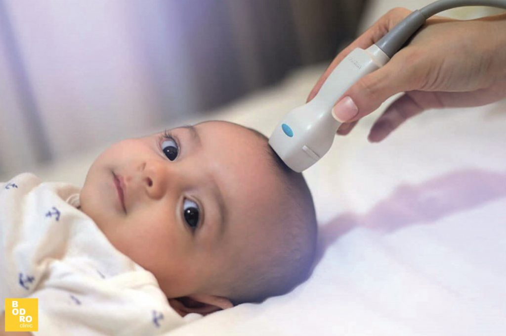 Що таке нейросонографія і навіщо вона потрібна вашому малюку?