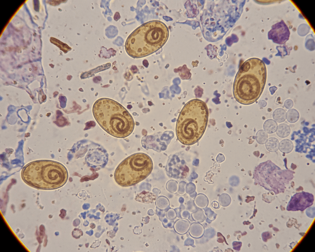 Аскаридоз: симптоми, сучасна діагностика та ефективне лікування в Києві